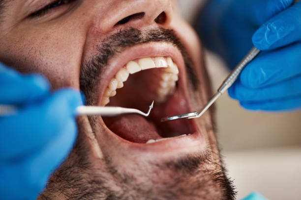Best Knocked-Out Tooth Emergency  in Haverhill, MA